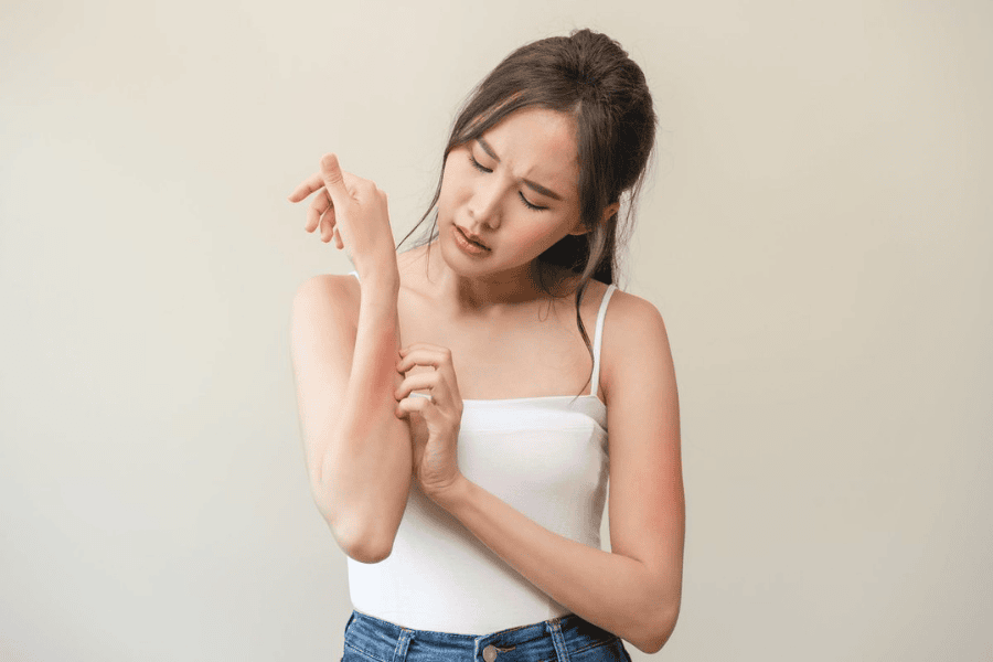 Kích ứng thường xảy ra khi để kem tẩy lông nách trên da quá lâu so với thời gian quy định