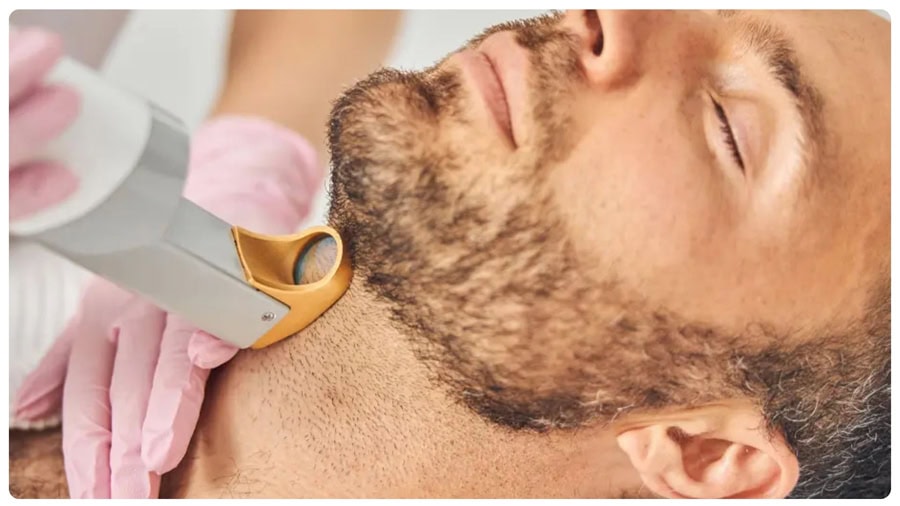 Kem triệt râu: Hiệu quả, so sánh và lưu ý quan trọng 6 Máy triệt râu tác động vào nang lông khiến râu mọc chậm hơn