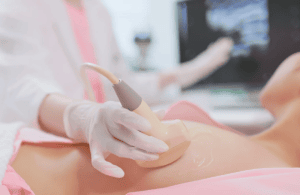 Nên gặp chuyên gia da liễu để được tư vấn phương án trị rạn da sớm nhất