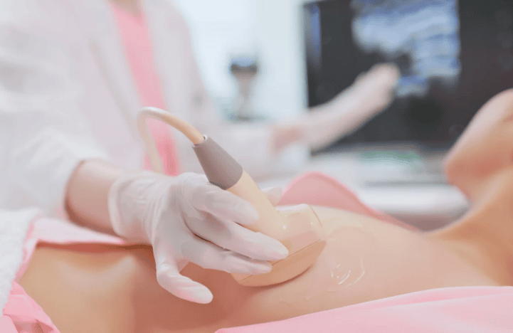 Nên gặp chuyên gia da liễu để được tư vấn phương án trị rạn da sớm nhất