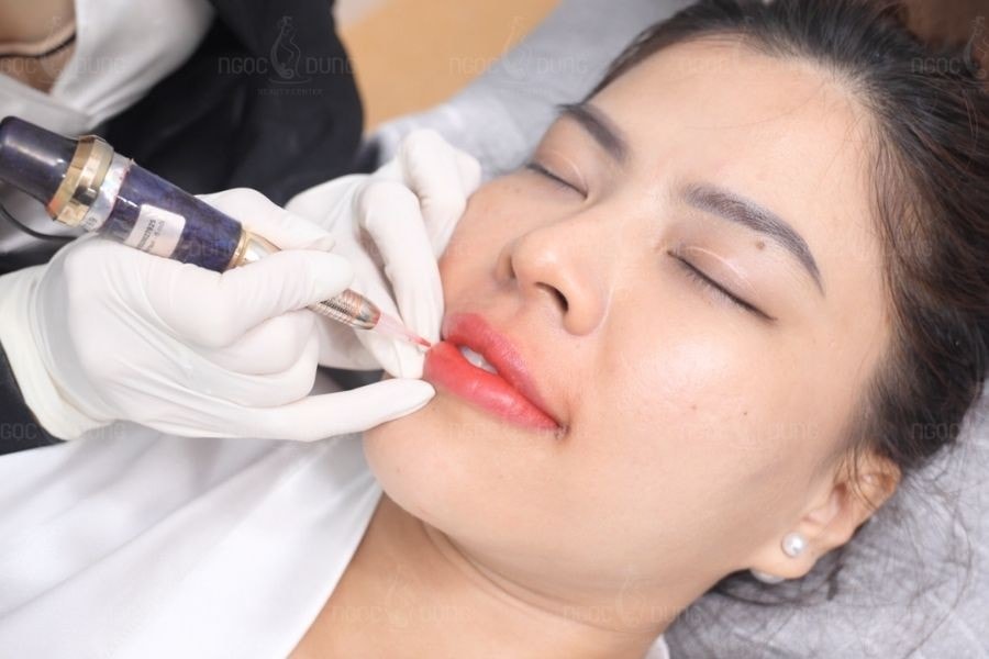 Rượu bia cũng là đáp án cho thắc mắc phun xăm môi kiêng ăn gì