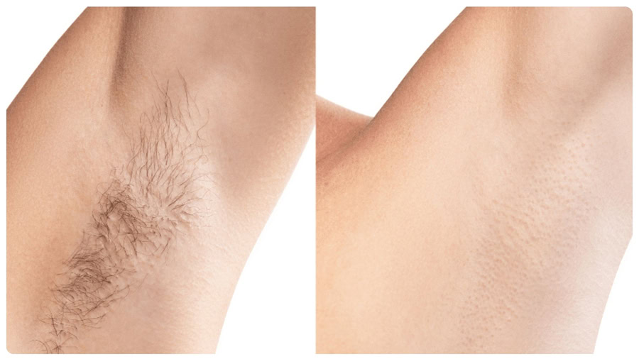 nho long nach co sao khong 12