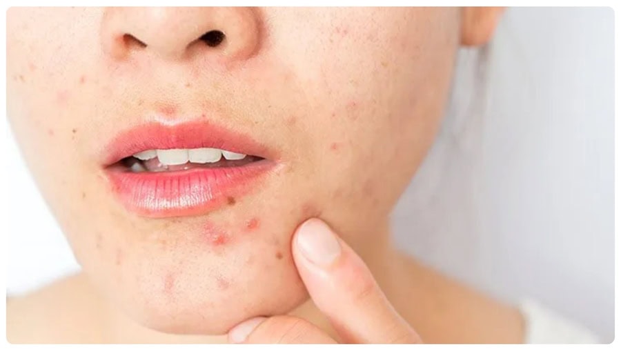 Khi gặp các dấu hiệu này, nên dừng triệt và tham khảo ý kiến chuyên gia.