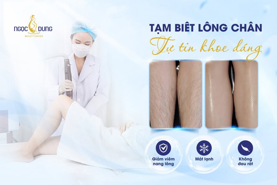 dịch vụ triệt lông chân