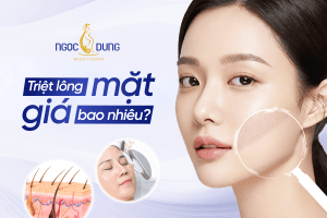 Triệt lông mặt giá bao nhiêu