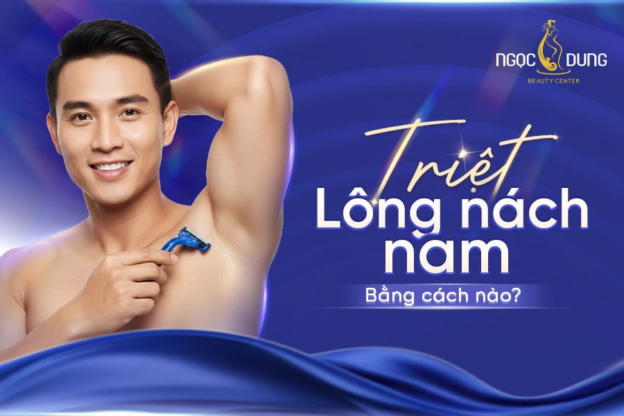 Triệt lông nách nam giá bao nhiêu