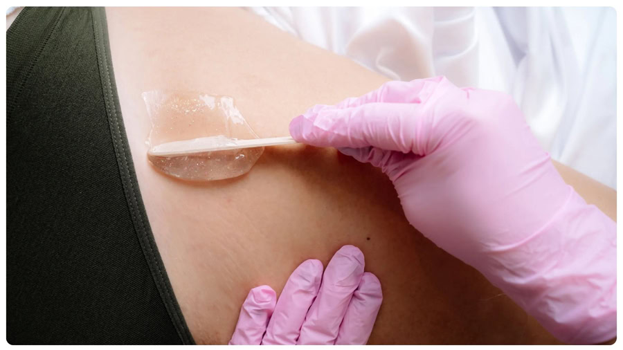 Triệt lông vĩnh viễn: Hiệu quả, rủi ro và cách chọn nơi uy tín 18 Nếu wax không đúng kỹ thuật có thể gây đau rát