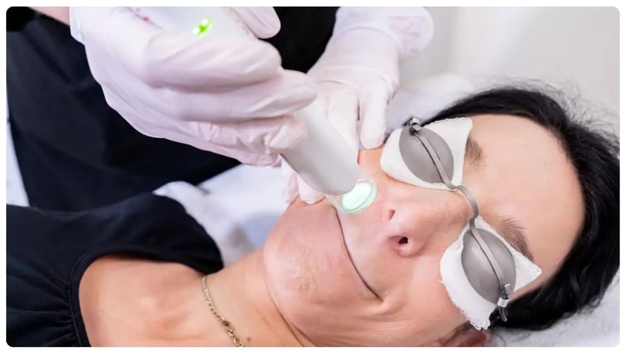 Triệt lông vĩnh viễn: Hiệu quả, rủi ro và cách chọn nơi uy tín 16 Triệt lông vĩnh viễn: Hiệu quả, rủi ro và cách chọn nơi uy tín