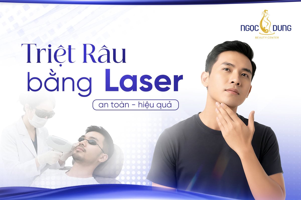 Triệt râu bằng laser