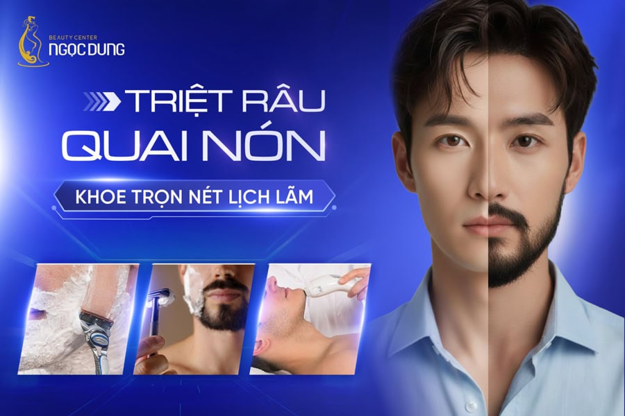 dịch vụ triệt râu quai nón