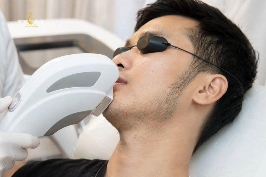 Cách triệt râu quai nón cho nam an toàn và hiệu quả 9 Triệt râu quai nón với công nghệ IPL