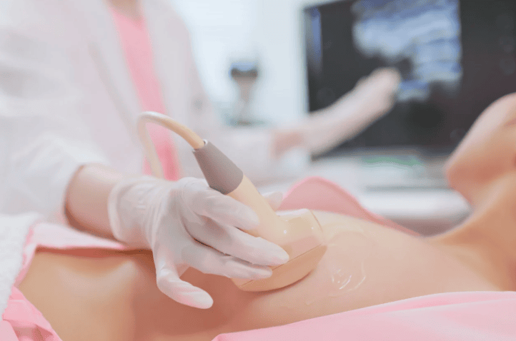 Vì sao nên trị thâm rạn ở ngực bằng công nghệ cao?