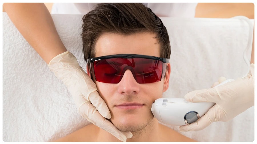 Wax râu có hại không? Giải đáp thắc mắc và lưu ý quan trọng 10 Sau mỗi liệu trình triệt, râu có xu hướng mọc chậm và thưa hơn