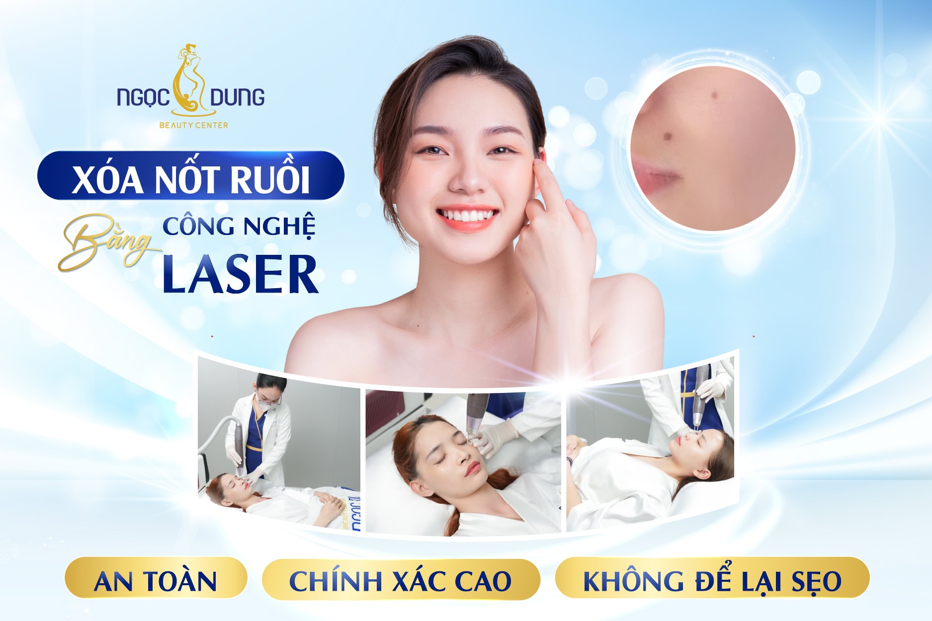 Tẩy nốt ruồi công nghệ cao – An toàn, thẩm mỹ tối ưu