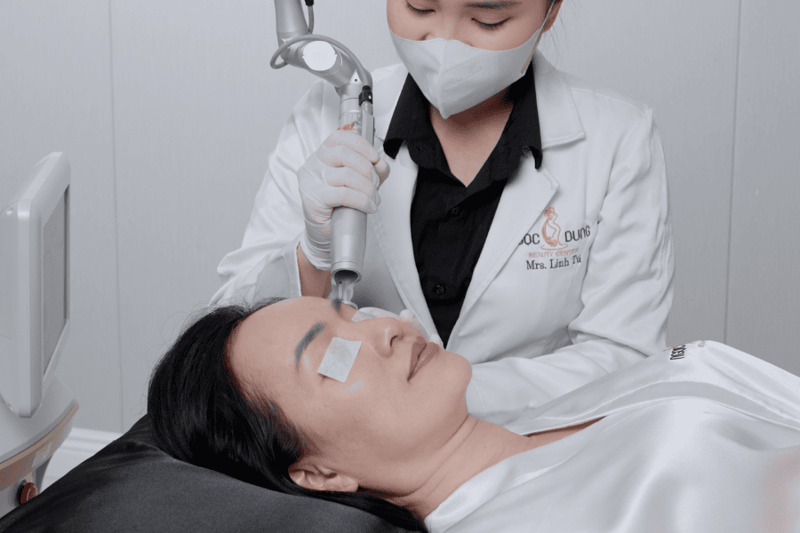 Khách hàng xóa xăm mí với Laser