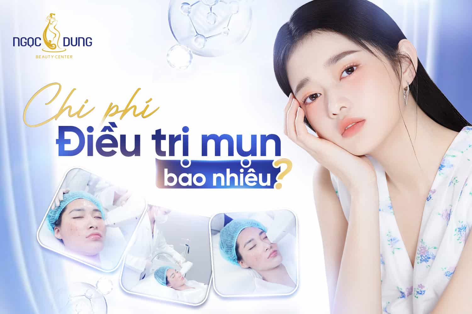 Chi phí điều trị mụn giá bao nhiêu? Bảng giá mới 2026 2 Chi phí điều trị mụn bao nhiêu?