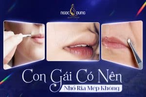 Con gái có nên nhổ ria mép không