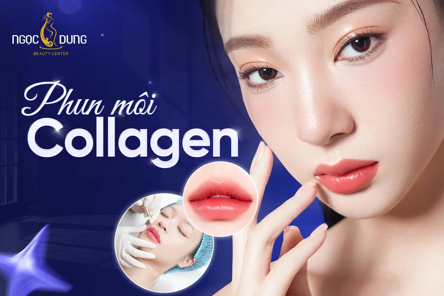Phun môi Collagen là gì? Phun môi Collagen giữ được bao lâu?