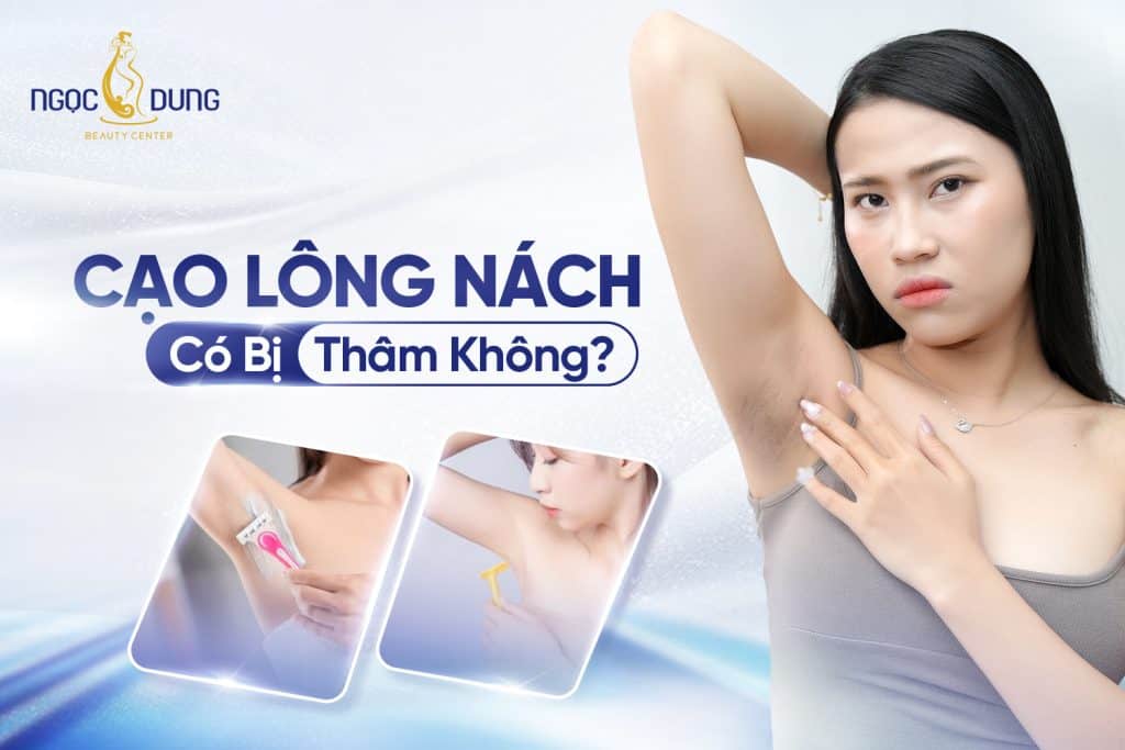 Cạo lông nách có bị thâm không? Một số lưu ý cần biết