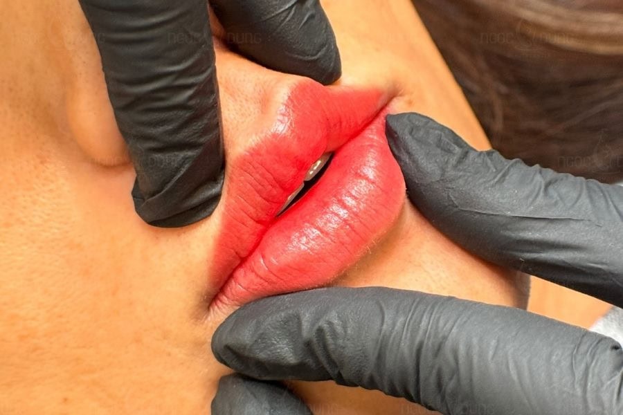 Vì là kỹ thuật hiện đại nên phun môi Collagen có giá thành tương đối cao 