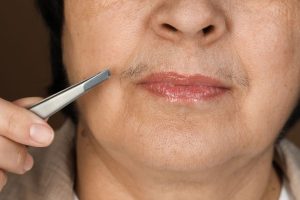 Dùng nhíp là phương pháp truyền thống, phù hợp để xử lý những sợi lông ria mép mọc lẻ tẻ