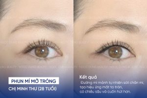 phun mí mở tròng 1