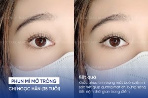 phun mí mở tròng 2