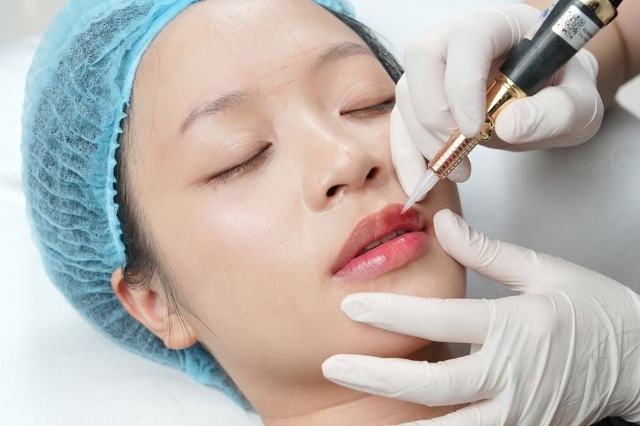 Phun môi Collagen là giải pháp phù hợp với những người có môi khô, xỉn màu