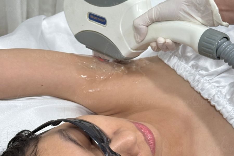 Ngọc Dung mang đến công nghệ triệt lông hiện đại và an toàn cho làn da của khách hàng