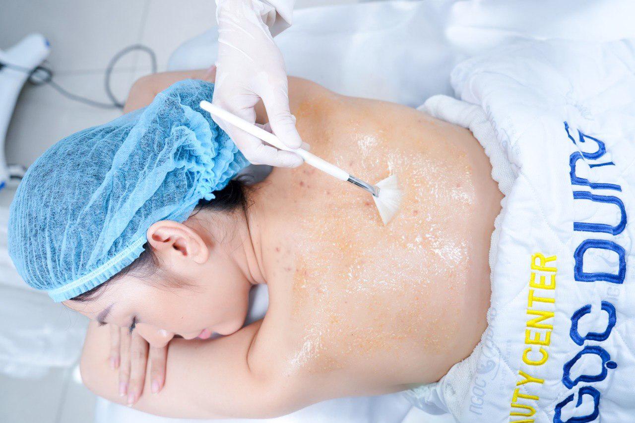 Chi phí điều trị mụn giá bao nhiêu? Bảng giá mới 2026 8 word image 127763 3 1