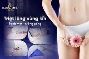 Triệt lông vùng kín có đau không? Ưu và nhược điểm
