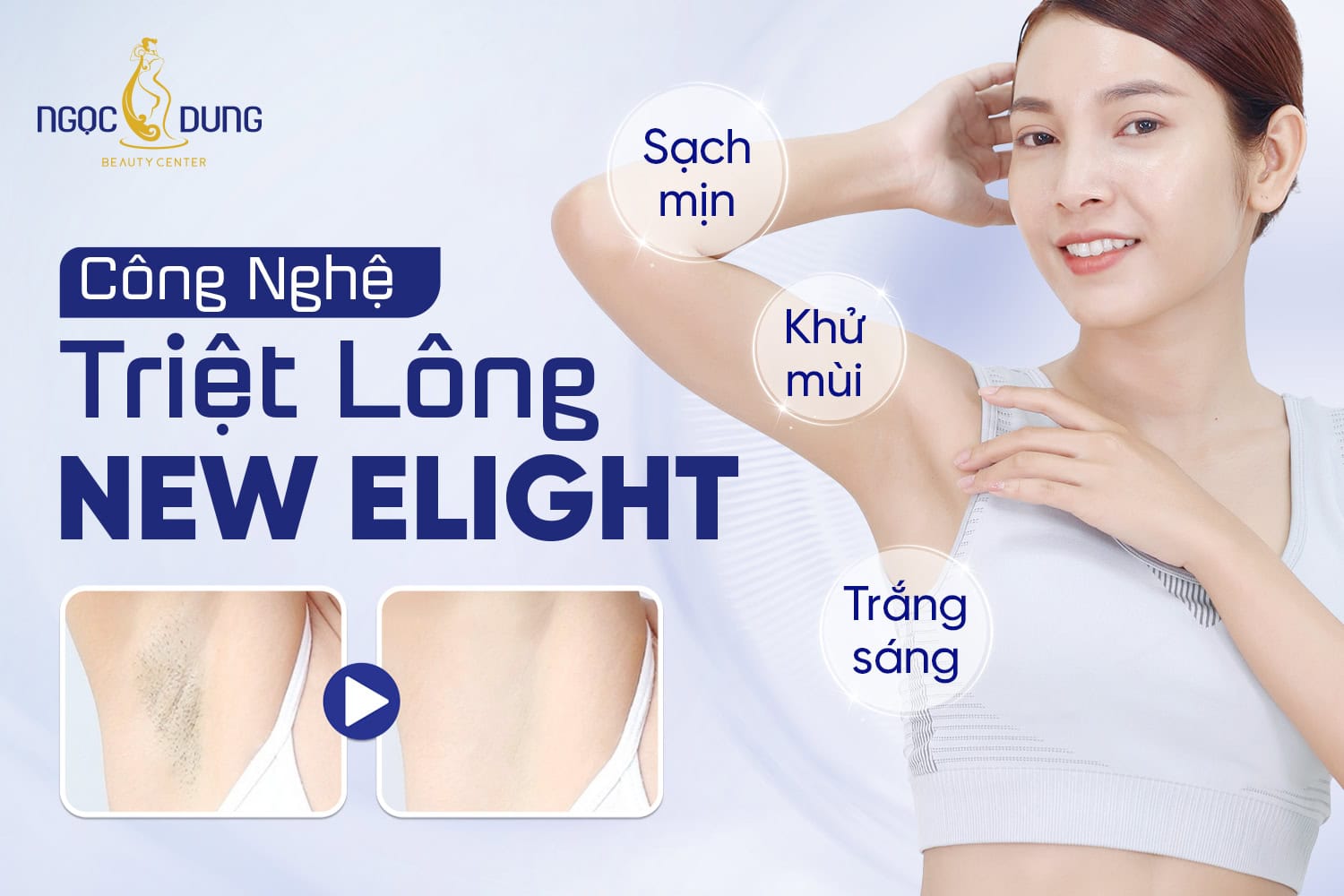 Triệt lông bằng công nghệ New Elight có tốt không?