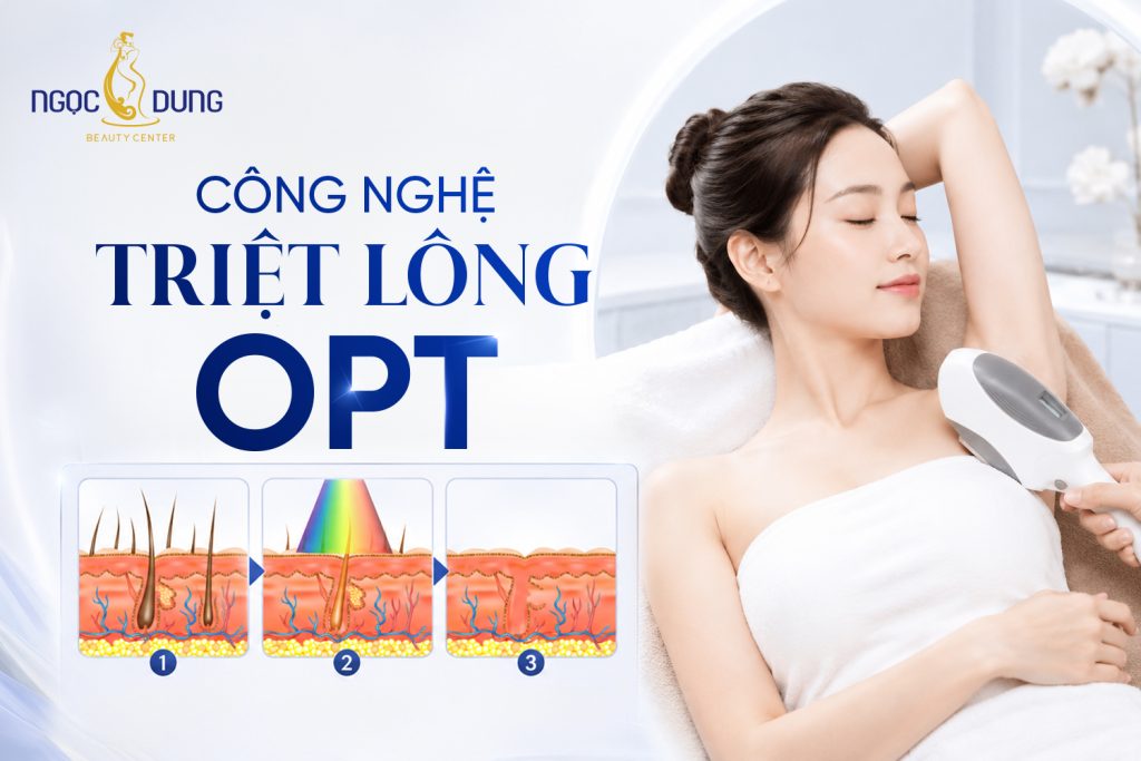 Công nghệ triệt lông OPT là gì? Có hiệu quả thực sự không?