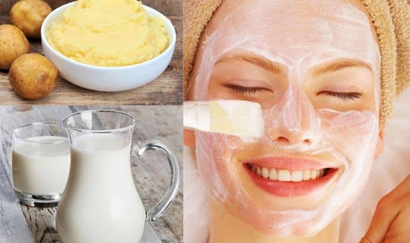 Mặt nạ sữa tươi không đường và khoai tây
