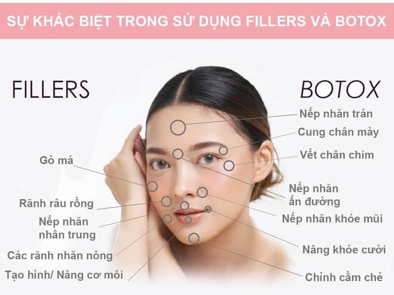 botox-va-filler