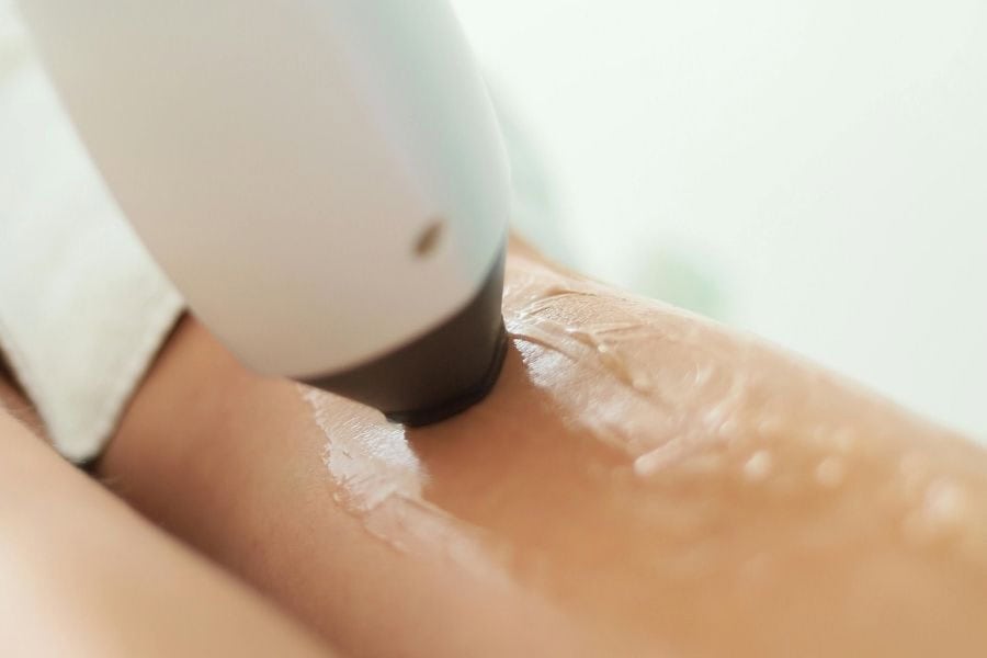 Bảng giá triệt lông vĩnh viễn còn thay đổi theo công nghệ triệt lông