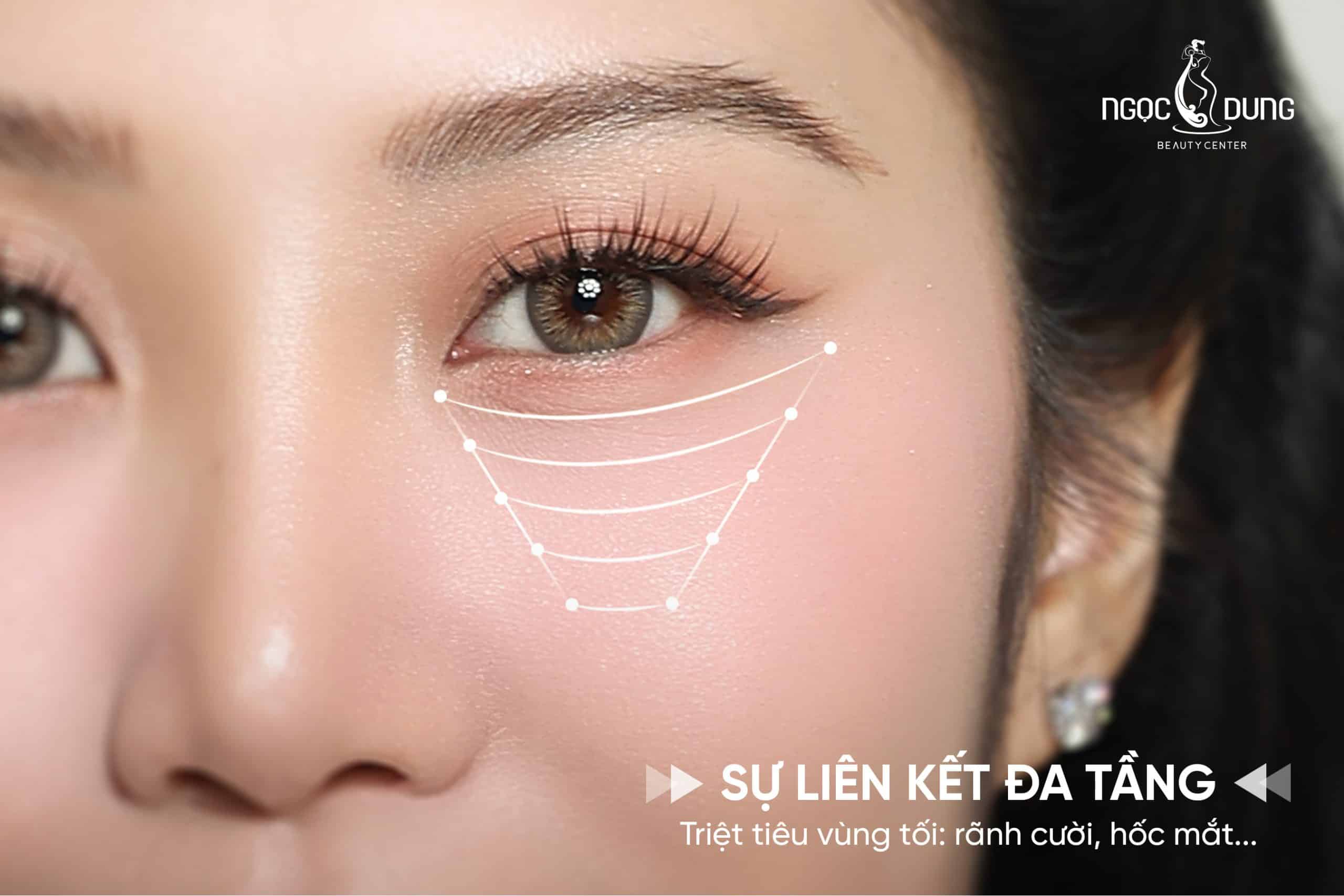 Bí mật đằng sau khung hình KHÔNG GÓC CHẾT của minh tinh 3 Một gương mặt không góc chết đòi hỏi sự phẳng mịn và liên kết chặt chẽ giữa các vùng da