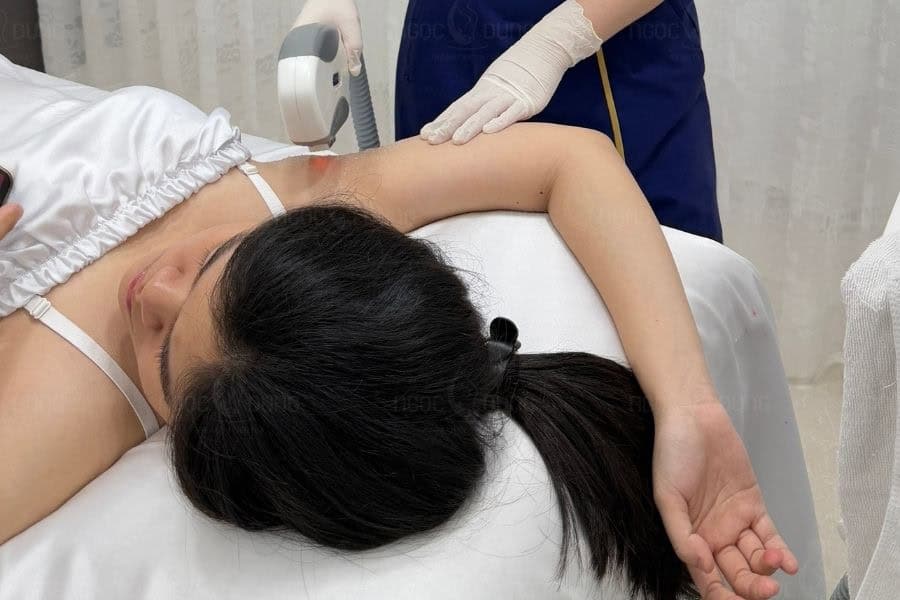 Công nghệ triệt lông OPT là gì? Có hiệu quả thực sự không? 5 Tiến hành đi tia triệt lông OPT lên da sau khi bôi gel làm mát