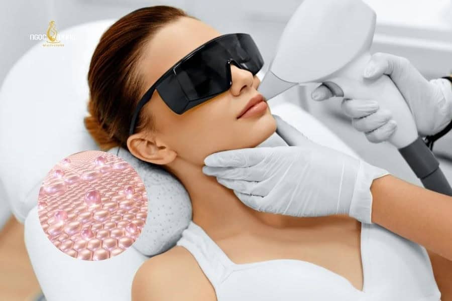 Triệt lông mặt còn hỗ trợ cho mỹ phẩm thẩm thấu sâu vào da hơn