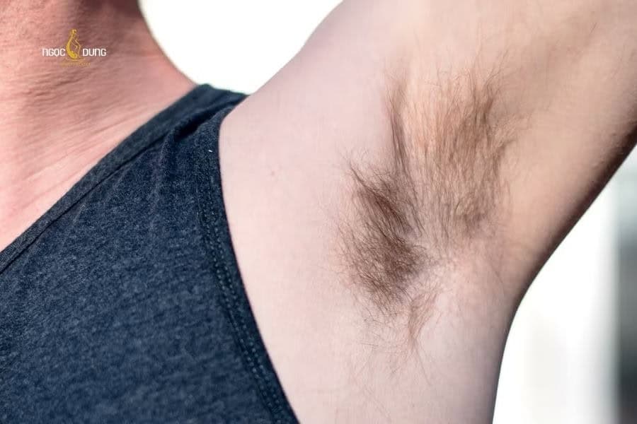 Lông nách hỗ trợ chăm sóc sức khỏe làn da nếu được giữ sạch và chăm sóc đúng cách