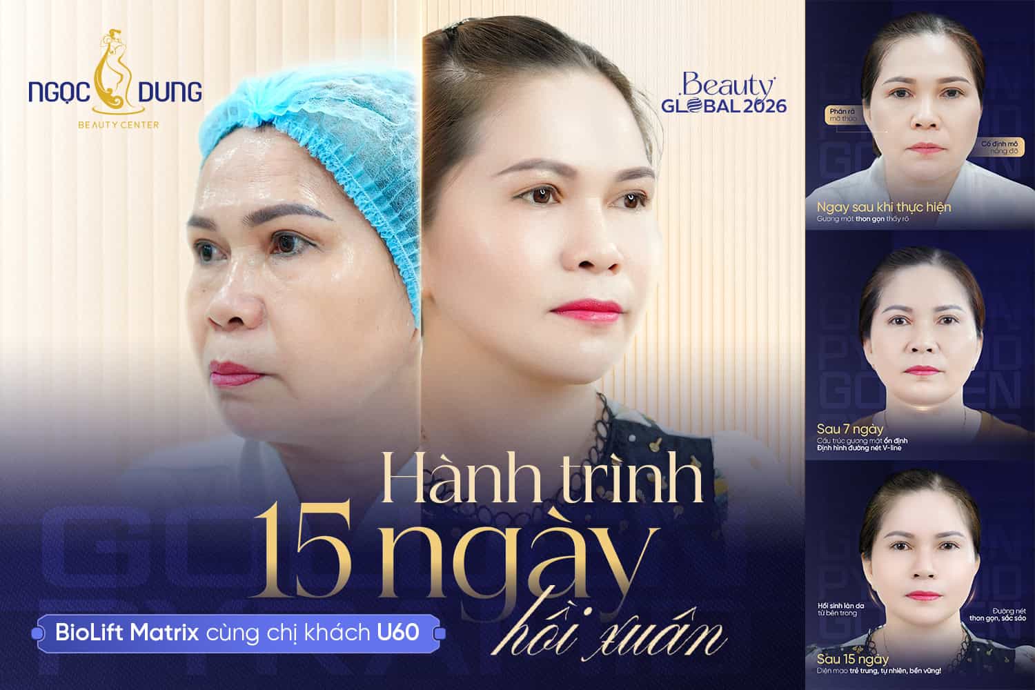 Sự thay đổi ngoạn mục của khách hàng sau liệu trình BioLift Matrix
