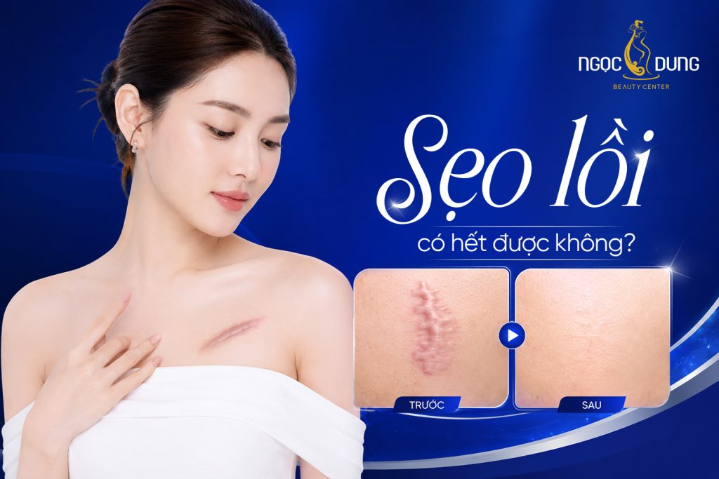 20260529 PosTM SEO 1751