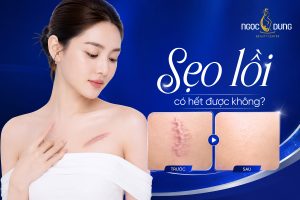 20260529 PosTM SEO 1751