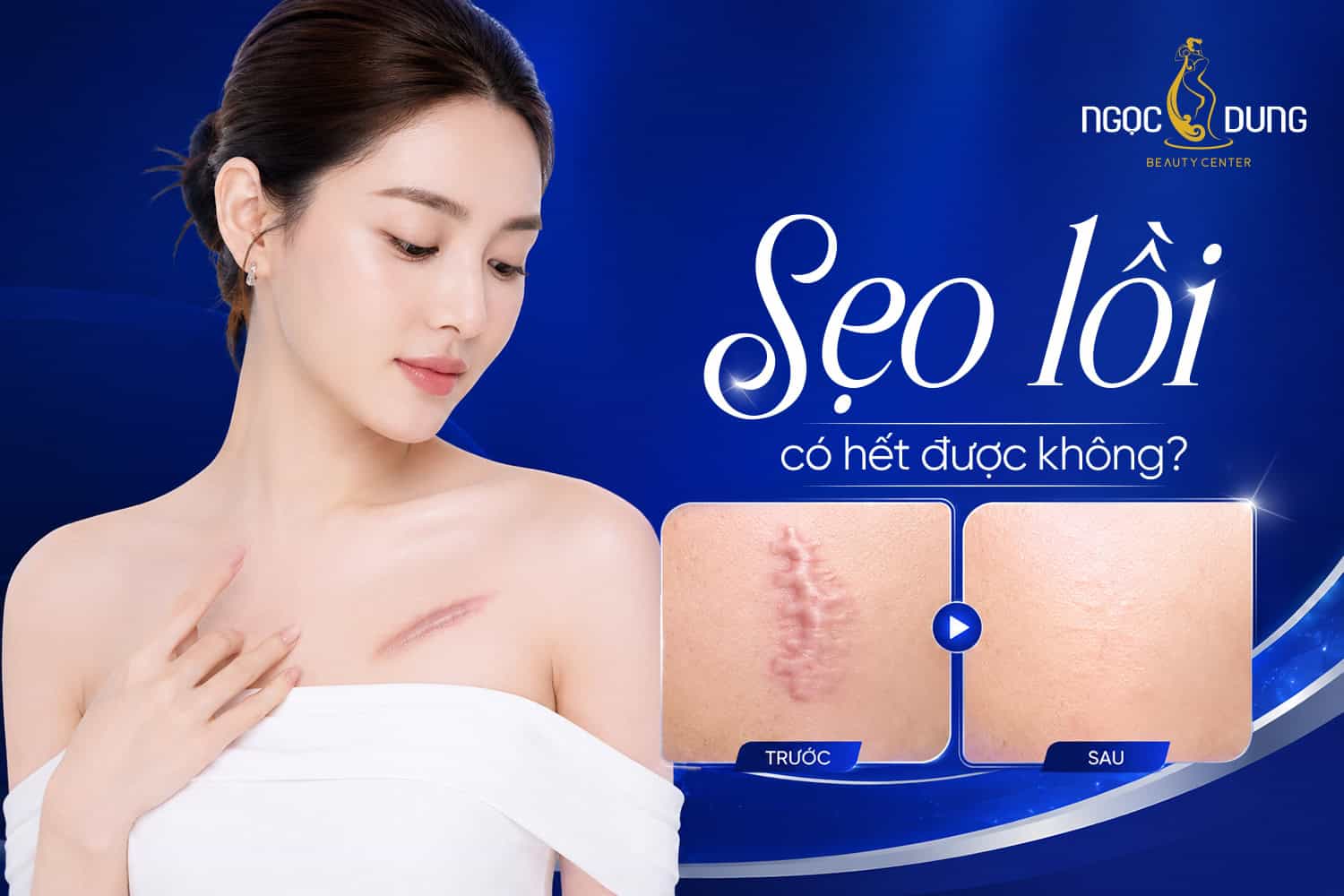 20260529 PosTM SEO 1751