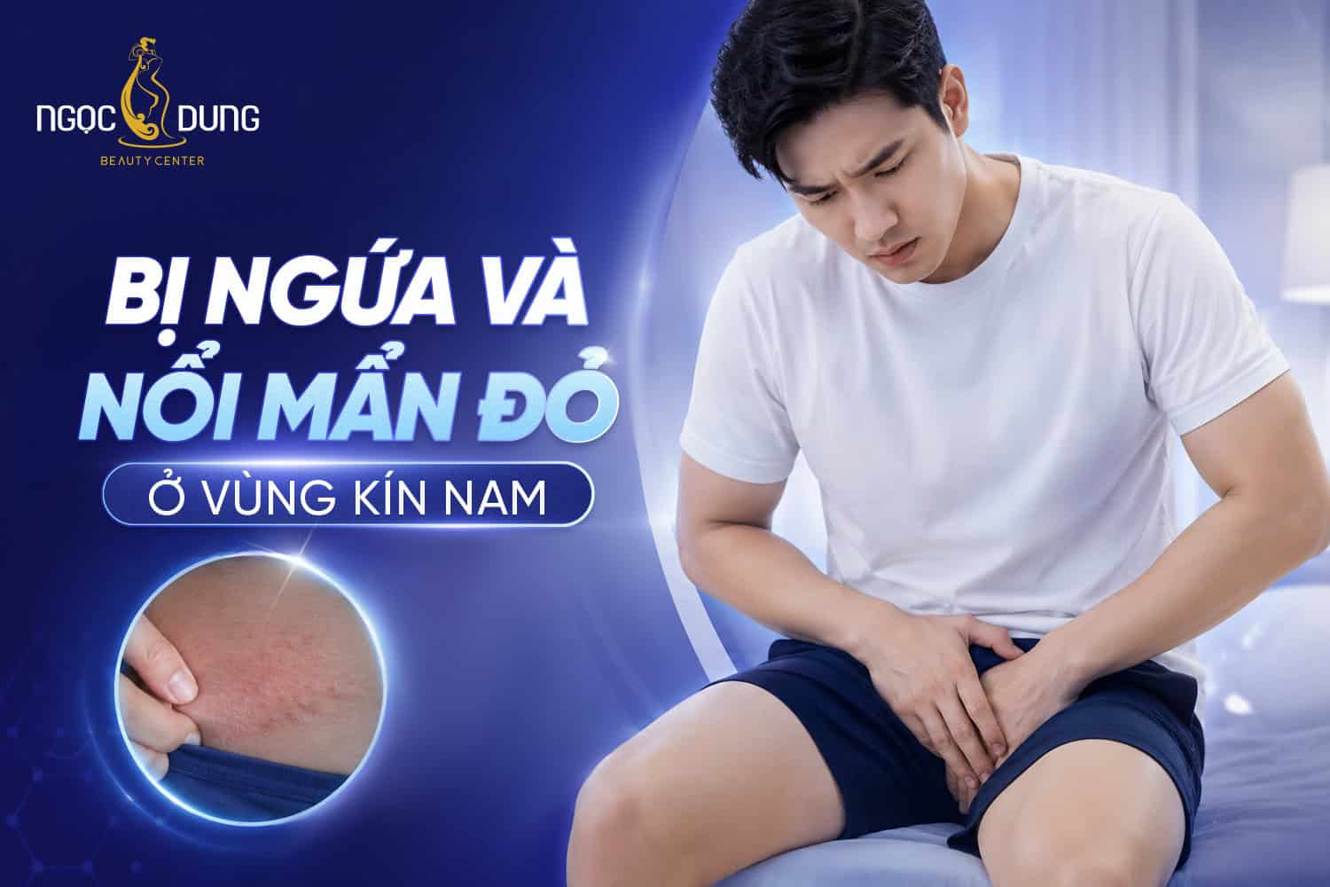 Bị ngứa và nổi mẩn đỏ ở vùng kín nam là dấu hiệu gì?