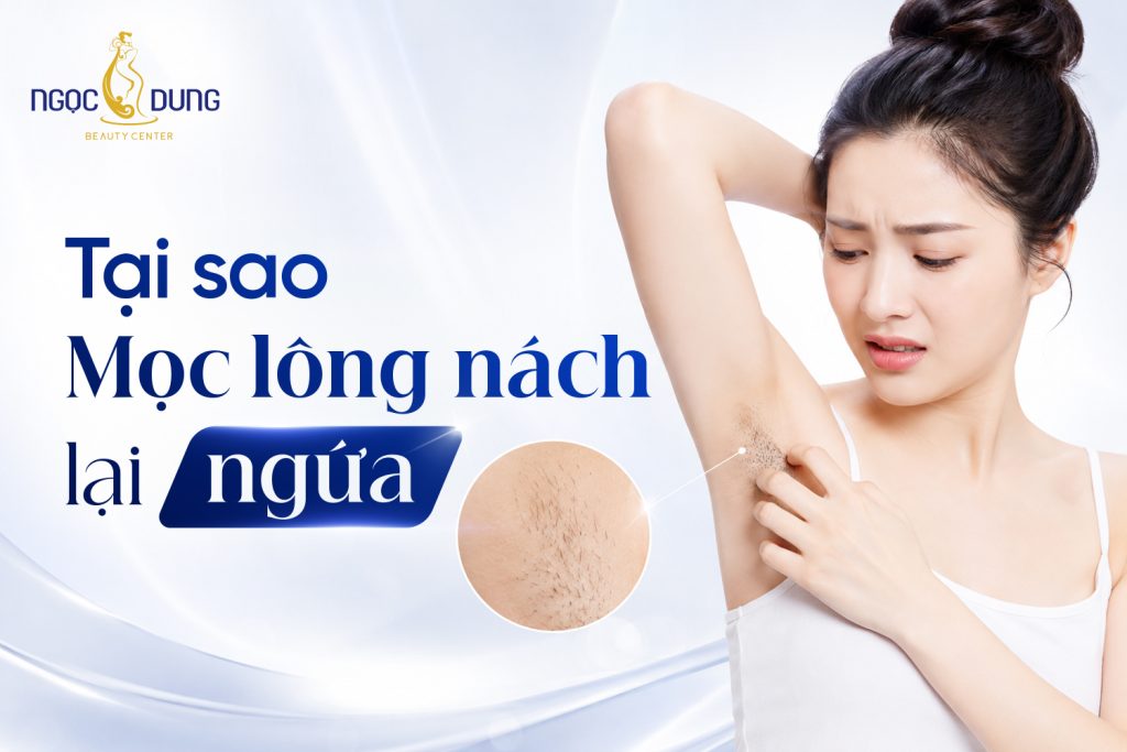 Tại sao mọc lông nách lại ngứa? Dấu hiệu cần lưu ý ngay