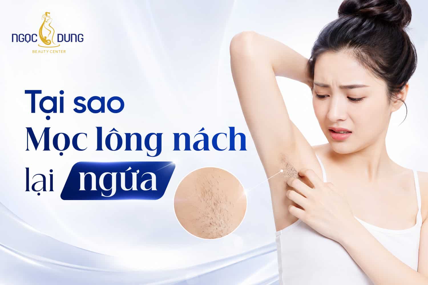 Tại sao mọc lông nách lại ngứa? Dấu hiệu cần lưu ý ngay 2 Tại sao mọc lông nách lại ngứa? Dấu hiệu cần lưu ý ngay