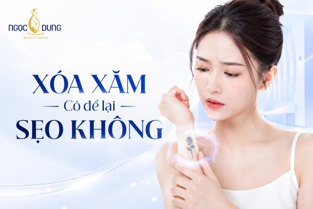 Xóa xăm có để lại sẹo không? Câu trả lời từ chuyên gia