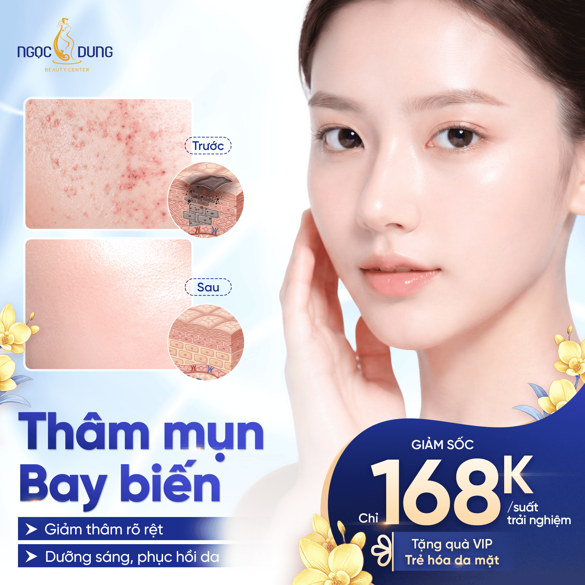 TRỊ THÂM MỤN