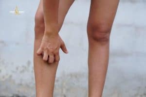 Cạo lông chân bị ngứa thường xuất phát từ việc da bị kích ứng trong quá trình cạo